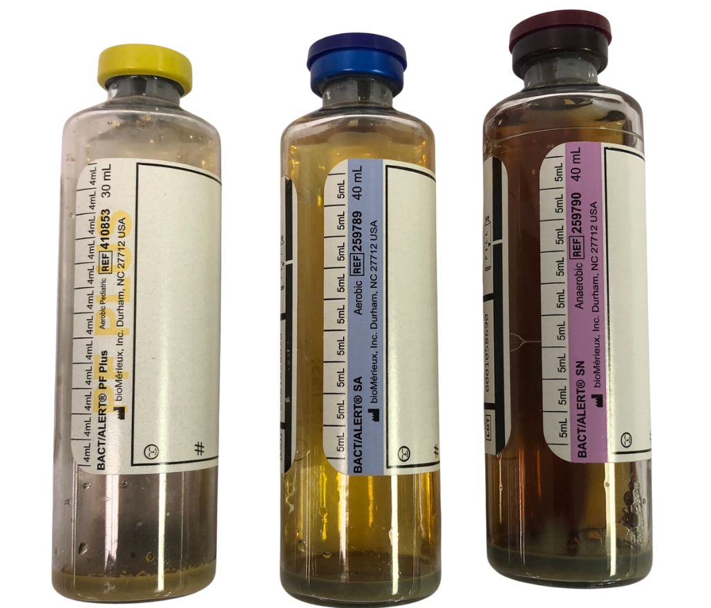 Bottles, Bacteria Alert Testing